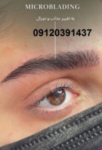 میکروبلیدینگ و هاشور ابرو در صادقیه 1 میکروبلیدینگ و هاشور ابرو در صادقیه