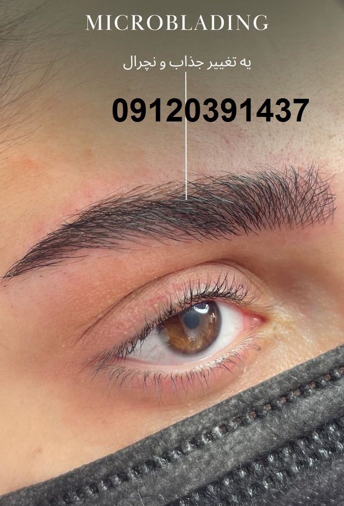 لیلیام بیوتی 36 میکروبلیدینگ و هاشور ابرو در صادقیه