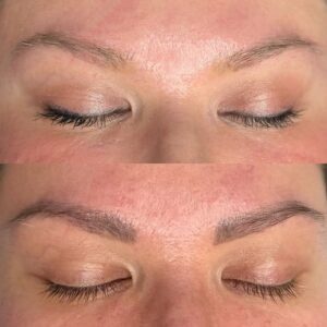 ریموو ابرو در تهرانسر