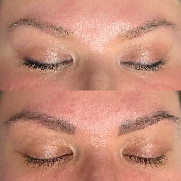 ریموو ابرو در تهرانسر