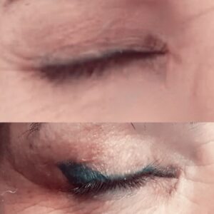 ریموو خط چشم در تهرانسر