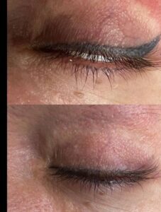  آموزش ریموو در تهرانسر