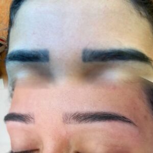 ریموو در تهرانسر