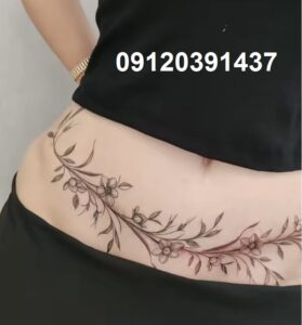 کاور جای بخیه با تتو 4 تتو روی اسکار جراحی