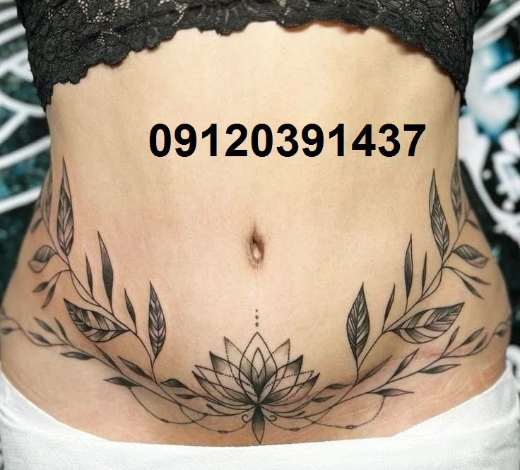 کاور جای بخیه با تتو 13 کاور بخیه سزارین با تتو